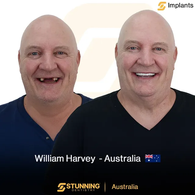 Full Mouth – photo 1