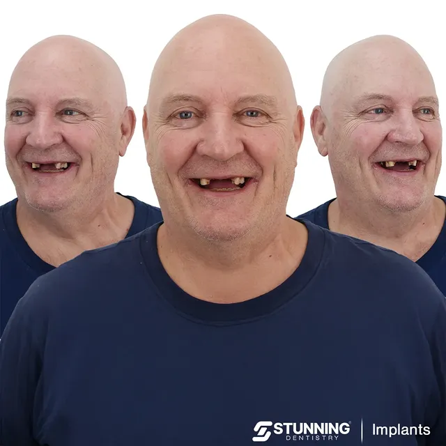 Full Mouth – photo 2