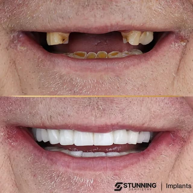 Full Mouth – photo 3