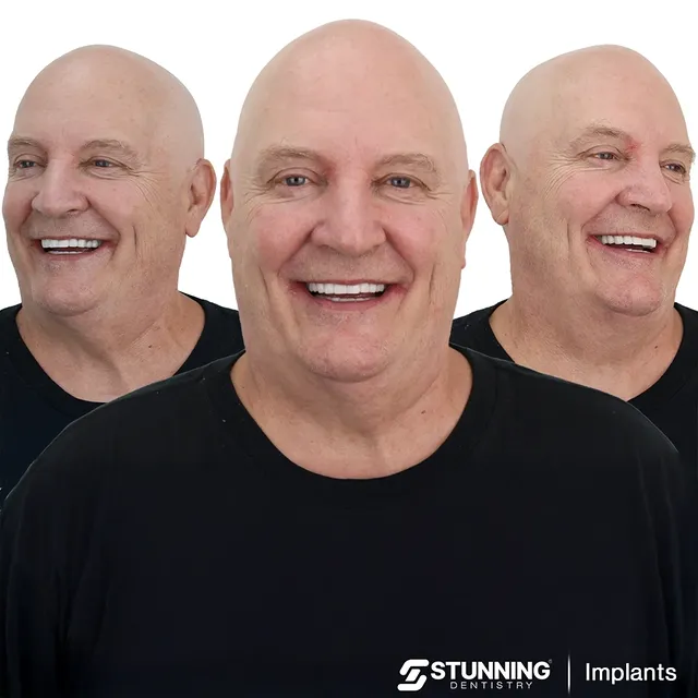 Full Mouth – photo 4