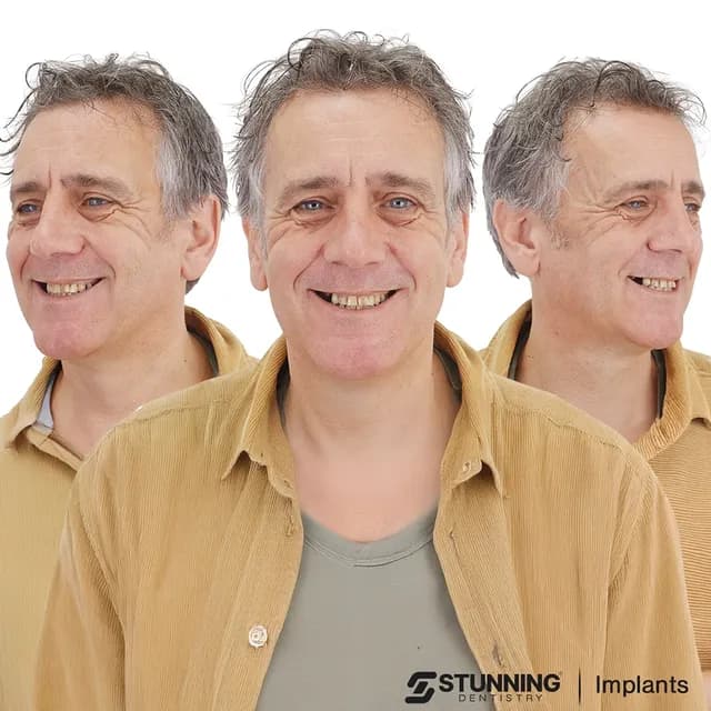 Full Mouth, UK – photo 1