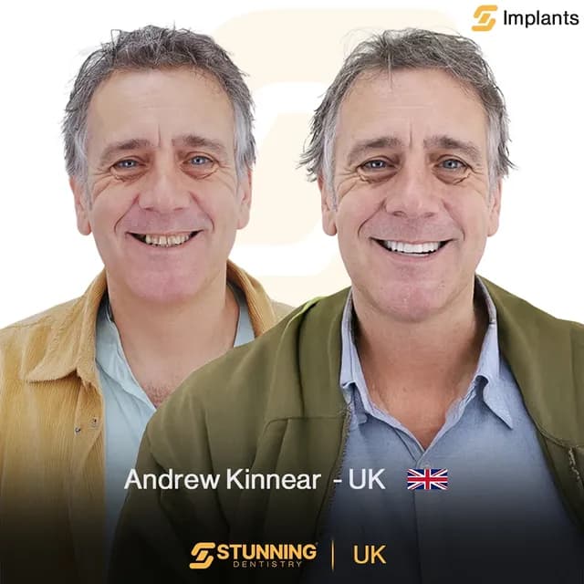 Full Mouth, UK – photo 2