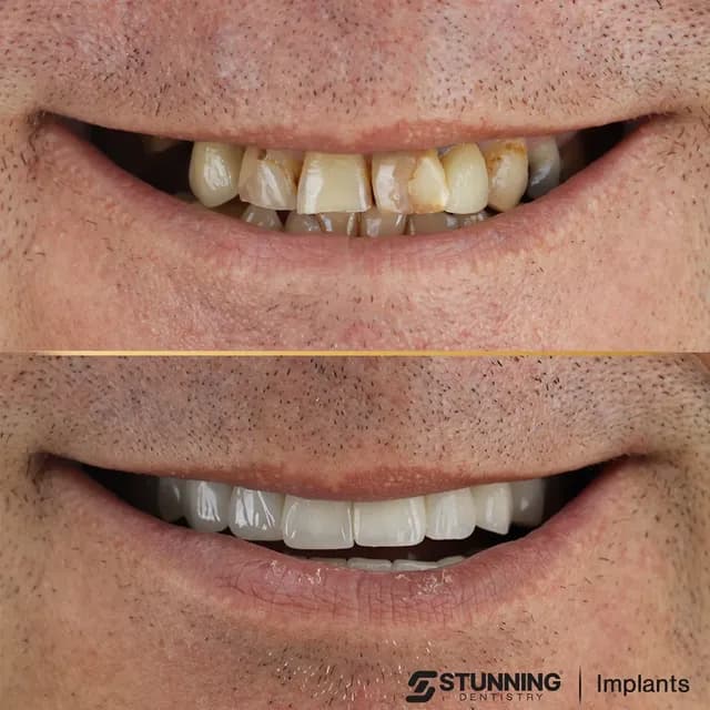 Full Mouth, UK – photo 3