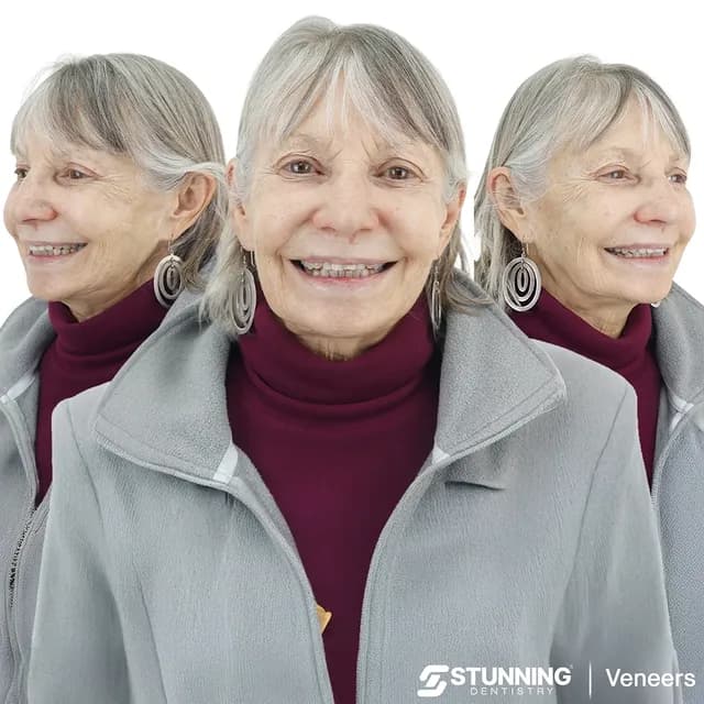 Smile Makeover, USA – photo 1