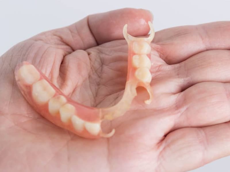 Benefits Over Conventional Dentures