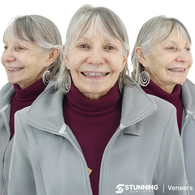 Smile Makeover, USA – photo 1