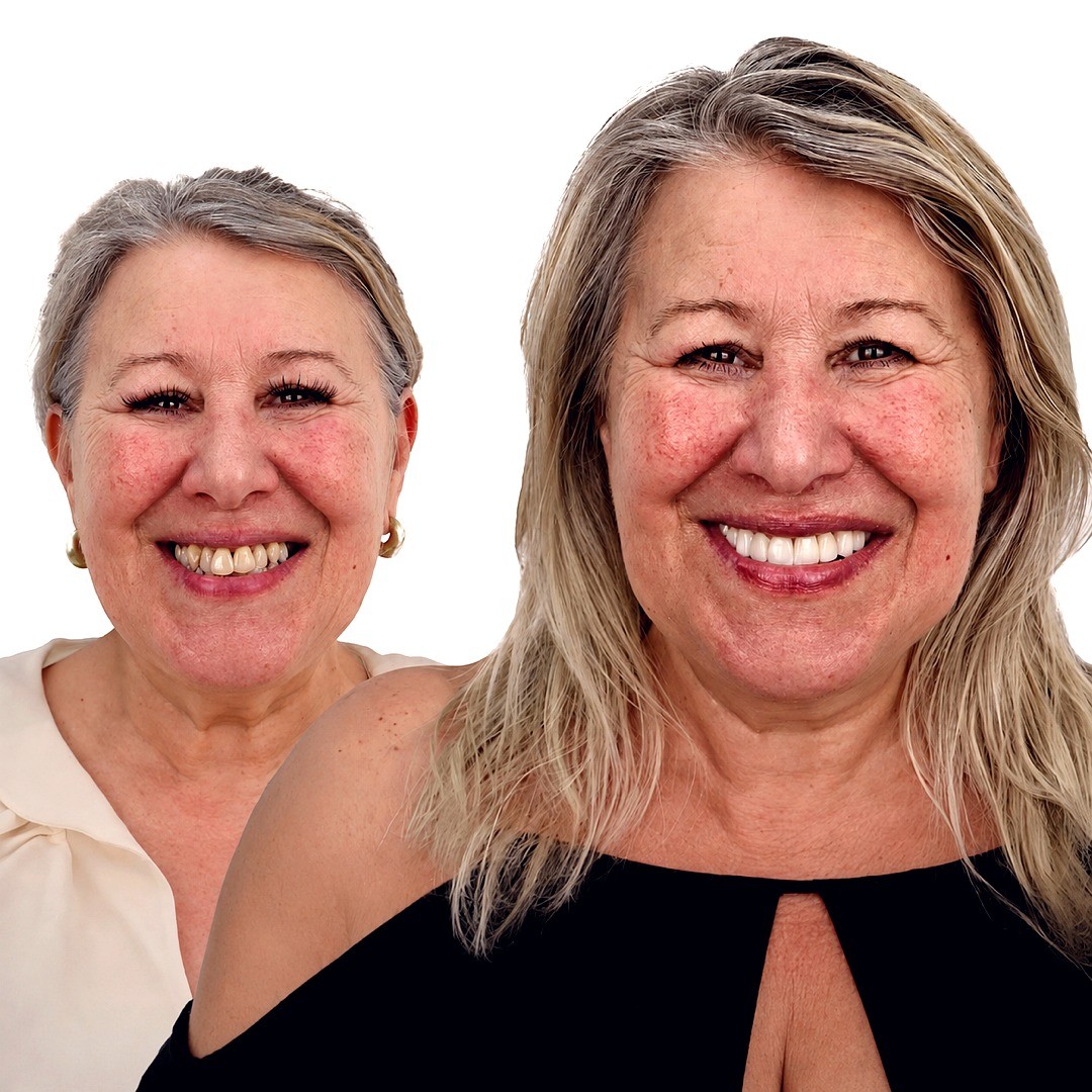 Full Smile Transformation - photo 1