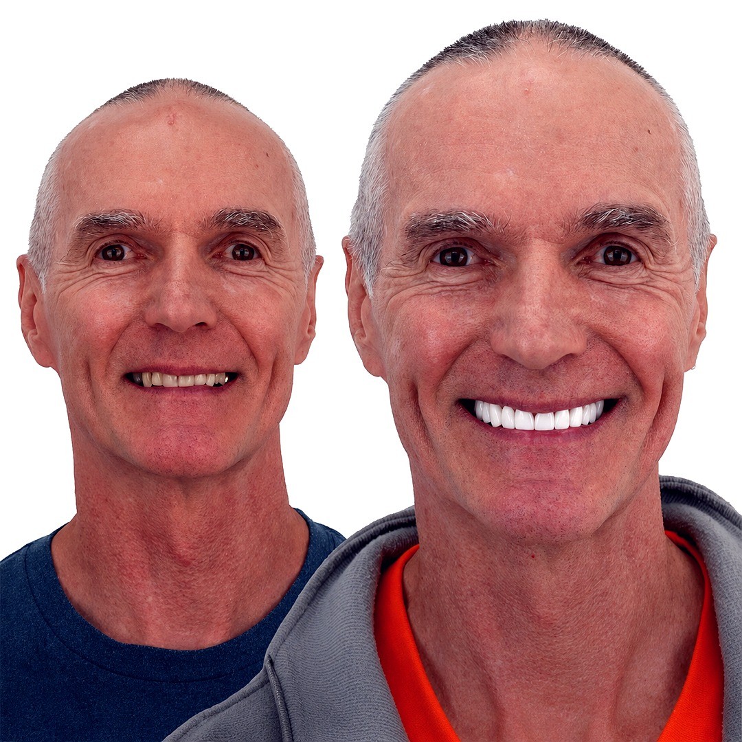 Full Smile Transformation - photo 2