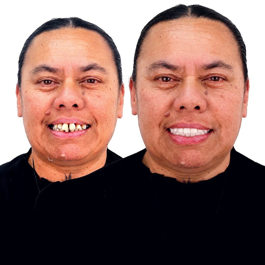 Full Smile Transformation - photo 3